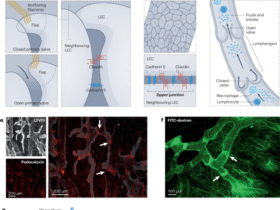 Cardiac lymphatic dysfunction and repair in cardiovascular disease