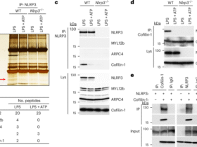 Cofilin-1 is a redox-sensitive guard of the NLRP3 inflammasome