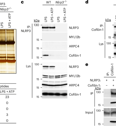 Cofilin-1 is a redox-sensitive guard of the NLRP3 inflammasome