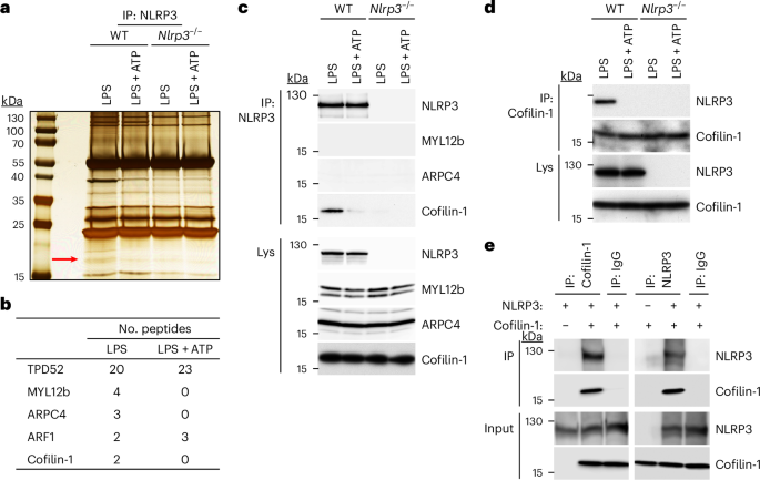 Cofilin-1 is a redox-sensitive guard of the NLRP3 inflammasome
