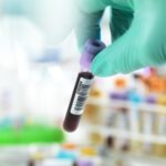 Common Blood Test Names and Meanings