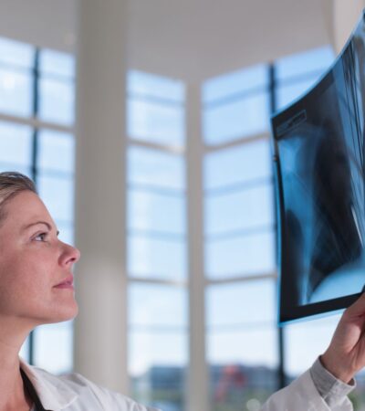 Common Causes of Multiple Lung Nodules