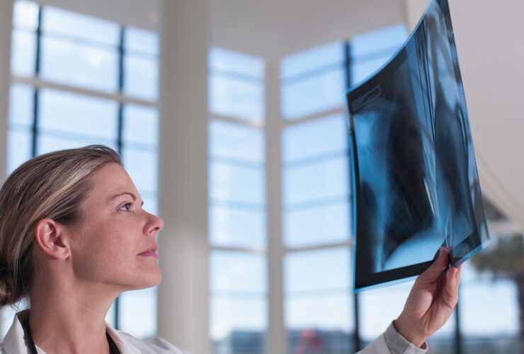 Common Causes of Multiple Lung Nodules