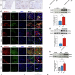 Complement 5a receptor 2 attenuates diabetic kidney disease by promoting mitochondria-associated endoplasmic reticulum membrane formation mediated by PSS-MFN2 interaction
