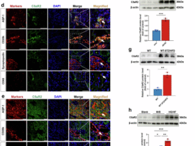 Complement 5a receptor 2 attenuates diabetic kidney disease by promoting mitochondria-associated endoplasmic reticulum membrane formation mediated by PSS-MFN2 interaction
