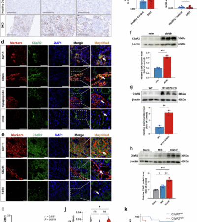 Complement 5a receptor 2 attenuates diabetic kidney disease by promoting mitochondria-associated endoplasmic reticulum membrane formation mediated by PSS-MFN2 interaction