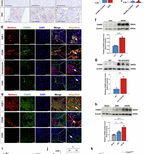 Complement 5a receptor 2 attenuates diabetic kidney disease by promoting mitochondria-associated endoplasmic reticulum membrane formation mediated by PSS-MFN2 interaction