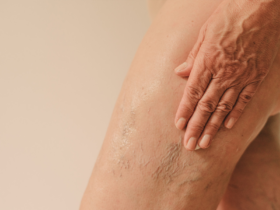 Crepey Skin On The Legs: Causes, Treatments & More