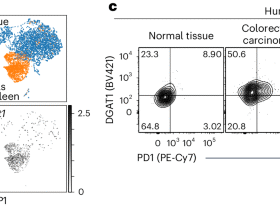 DGAT1 mediates sex-specific CD8+ T cell antitumour responses