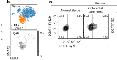 DGAT1 mediates sex-specific CD8+ T cell antitumour responses