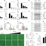 E3 ubiquitin ligase Stub1 enhances viral replication by promoting TBK1 degradation through molecular chaperone-mediated autophagy