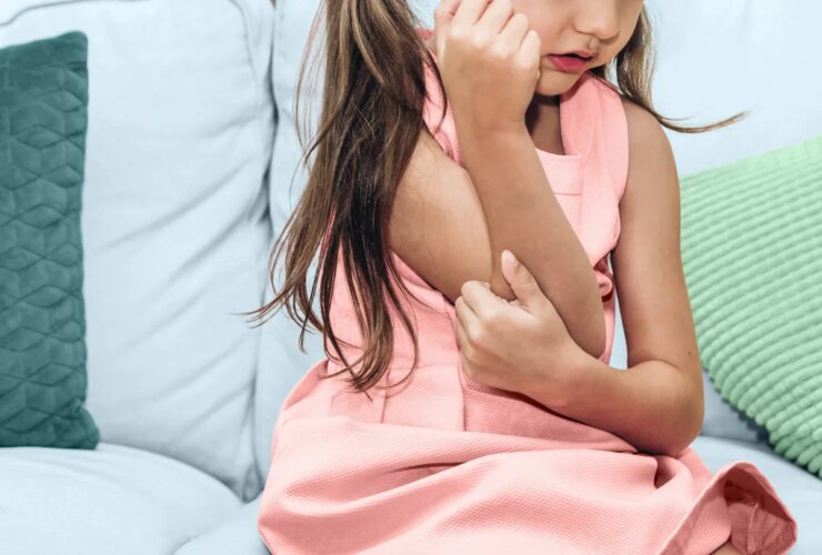 6 Early Signs of an Atopic Dermatitis Flare in Children