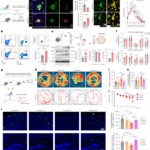 Exercise alleviates cognitive dysfunction in Alzheimer’s disease mice via skeletal muscle-derived extracellular vesicles that enhance plaque clearance by microglia