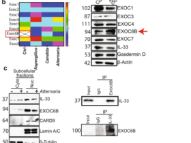Exocyst complex regulates fungal-mediated IL-33 release from cancer cells