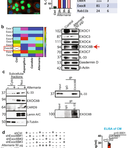 Exocyst complex regulates fungal-mediated IL-33 release from cancer cells