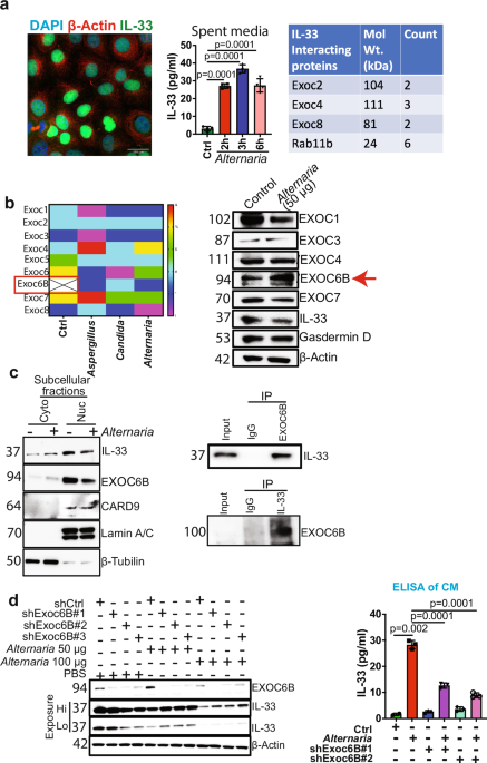 Exocyst complex regulates fungal-mediated IL-33 release from cancer cells