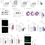 Hematopoietic expression of cIAP2 drives inflammation and heart failure after myocardial infarction