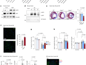 Hematopoietic expression of cIAP2 drives inflammation and heart failure after myocardial infarction