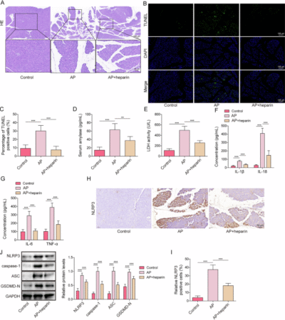 Heparin inhibits NLRP3-dependent pyroptosis in acute pancreatitis