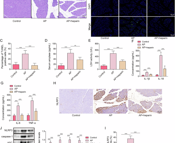 Heparin inhibits NLRP3-dependent pyroptosis in acute pancreatitis