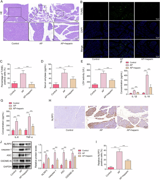 Heparin inhibits NLRP3-dependent pyroptosis in acute pancreatitis