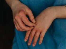 How Long Does Scabies Last?