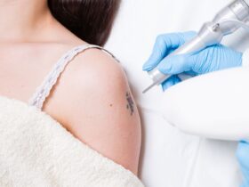 How Q-Switched Lasers Are Used