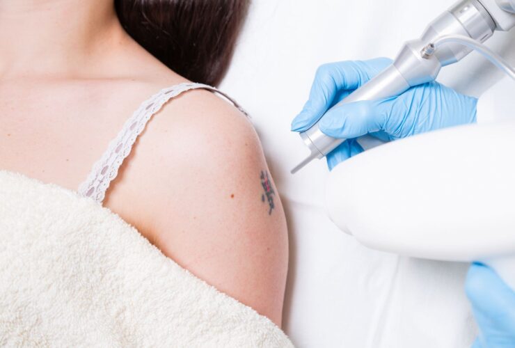 How Q-Switched Lasers Are Used