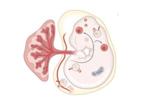 Immune mechanisms of congenital Zika syndrome | Science Immunology