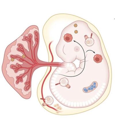 Immune mechanisms of congenital Zika syndrome | Science Immunology