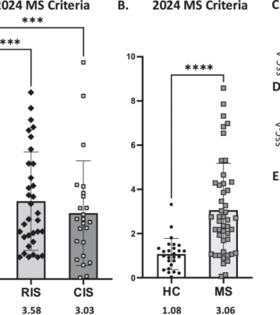 Increased VH4+JH6+ antibody heavy chain use in plasmablasts from asymptomatic multiple sclerosis patients