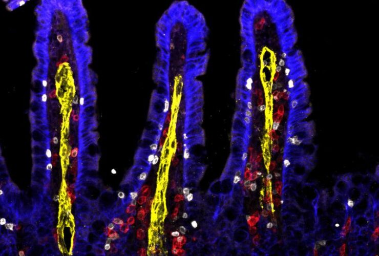 Inflammatory ILC2s migrate to distal tissues during infection using stage-specific S1P receptors | Science Immunology
