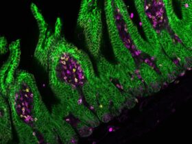 Intestinal epithelial MHC class II induces encephalitogenic CD4 T cells and initiates central nervous system autoimmunity | Science Immunology