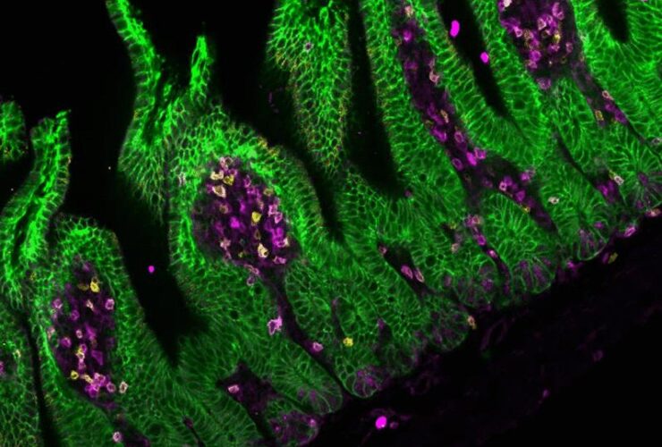 Intestinal epithelial MHC class II induces encephalitogenic CD4 T cells and initiates central nervous system autoimmunity | Science Immunology