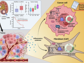 Intracellular complement Factor H promotes tumor progression through modulation of cell cycle and actin cytoskeleton