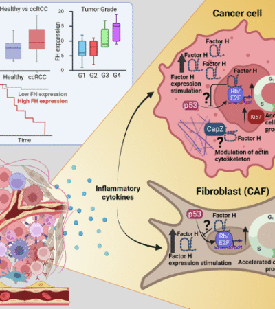 Intracellular complement Factor H promotes tumor progression through modulation of cell cycle and actin cytoskeleton