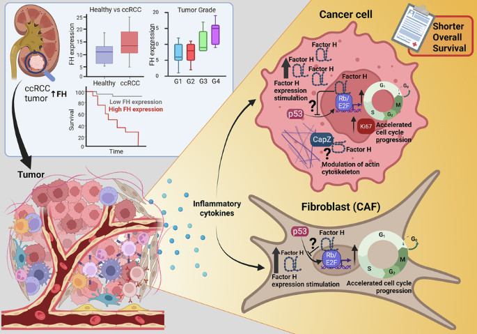 Intracellular complement Factor H promotes tumor progression through modulation of cell cycle and actin cytoskeleton