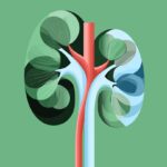 Kidney Transplant for C3G/IC-MPGN: What You Need to Know