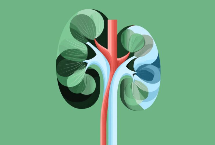 Kidney Transplant for C3G/IC-MPGN: What You Need to Know