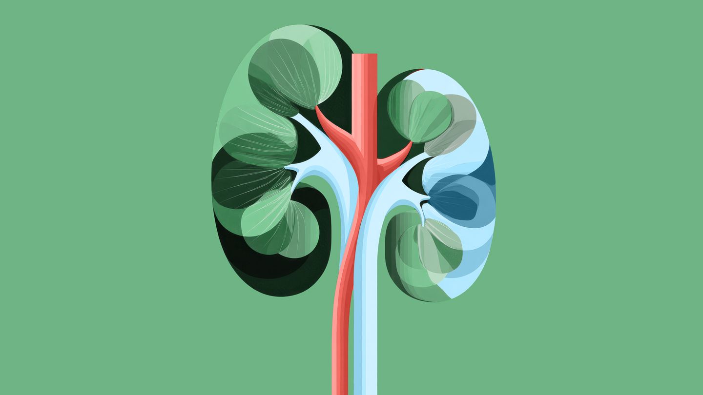 Kidney Transplant for C3G/IC-MPGN: What You Need to Know