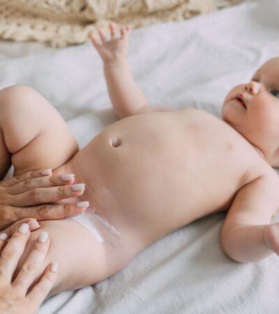 Lotrimin for Diaper Rash