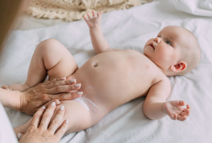 Lotrimin for Diaper Rash