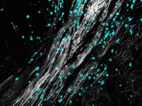 Macrophages restrict tumor immune infiltration by controlling collagen topography | Science Immunology