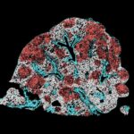 Modulating AP-1 enables CAR T cells to establish an intratumoral stemlike reservoir and overcomes resistance to PD-1 blockade | Science Immunology