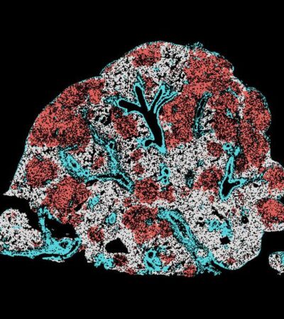 Modulating AP-1 enables CAR T cells to establish an intratumoral stemlike reservoir and overcomes resistance to PD-1 blockade | Science Immunology