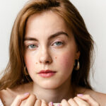 One Simple Trick For Covering Up Acne, From A Beauty Editor