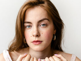 One Simple Trick For Covering Up Acne, From A Beauty Editor