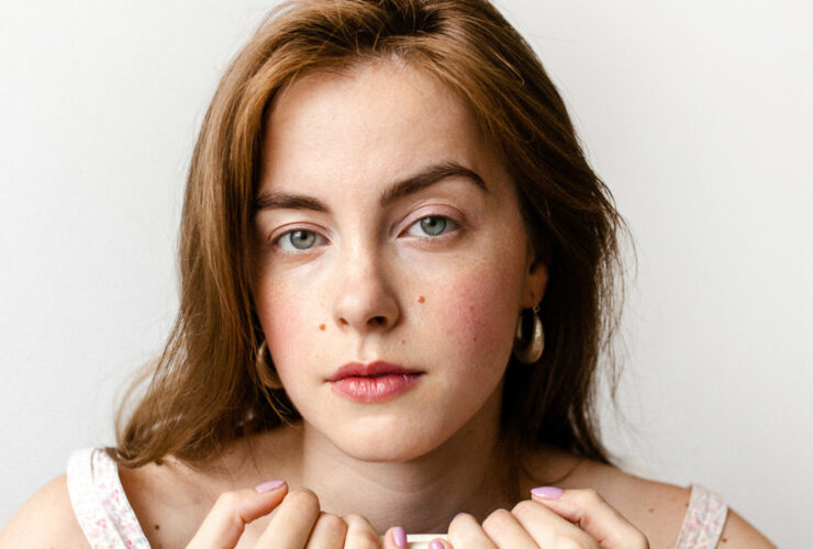 One Simple Trick For Covering Up Acne, From A Beauty Editor