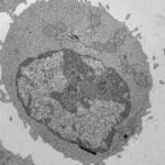 Palmitate-induced mitochondrial damage restricts histone acetylation in CD8 T cells to impair antitumor immunity | Science Immunology