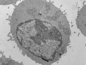 Palmitate-induced mitochondrial damage restricts histone acetylation in CD8 T cells to impair antitumor immunity | Science Immunology